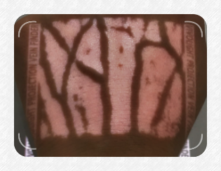 VEINCAS vein finder bright