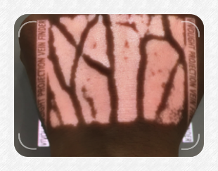 VEINCAS vein finder bright