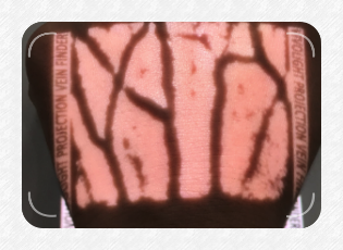 VEINCAS vein finder bright