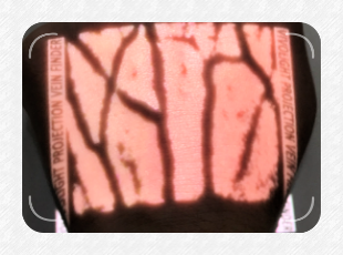VEINCAS vein finder bright
