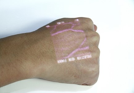 VEINCAS vein finder colour