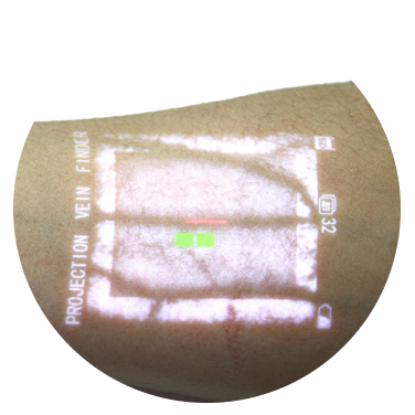 VEINCAS vein finder depth
