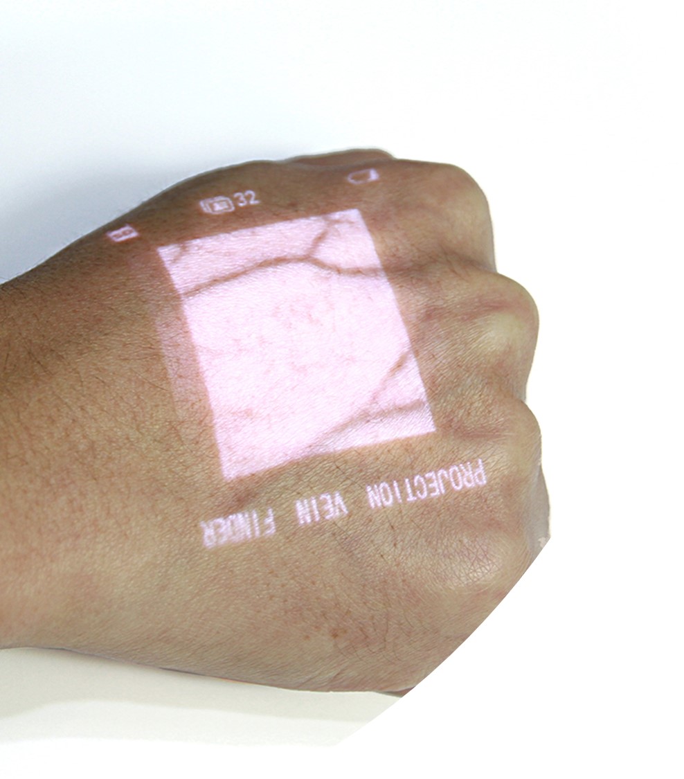 VEINCAS vein finder fine image